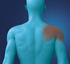 trigger point shoulder pain muscle pain relief
